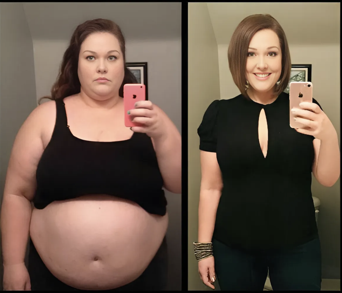 Bryan S. Vorher Nachher